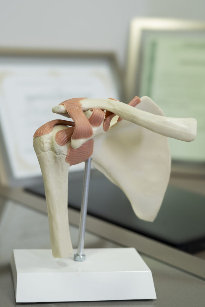 Imagem médica de ombro e cotovelo
